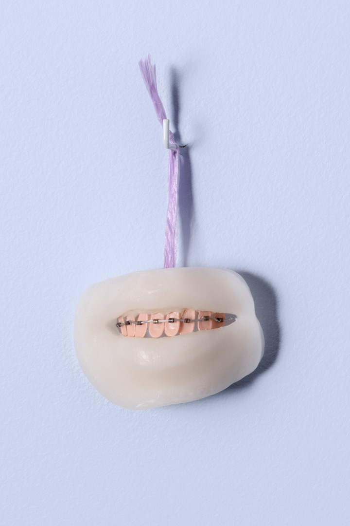 Fragment de l'installation Spleen Spring. Focus sur une forme en cire représentant un sourire. Les dents en plastique rose iridescent sont munies d'un appareil dentaire.