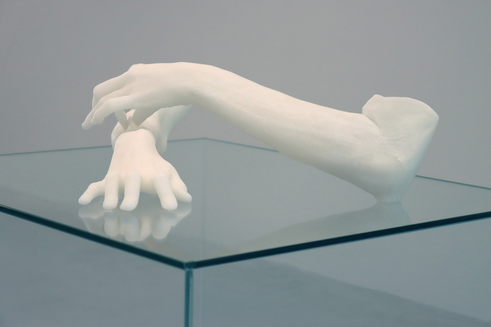 bottereau-fiquet-phalanges